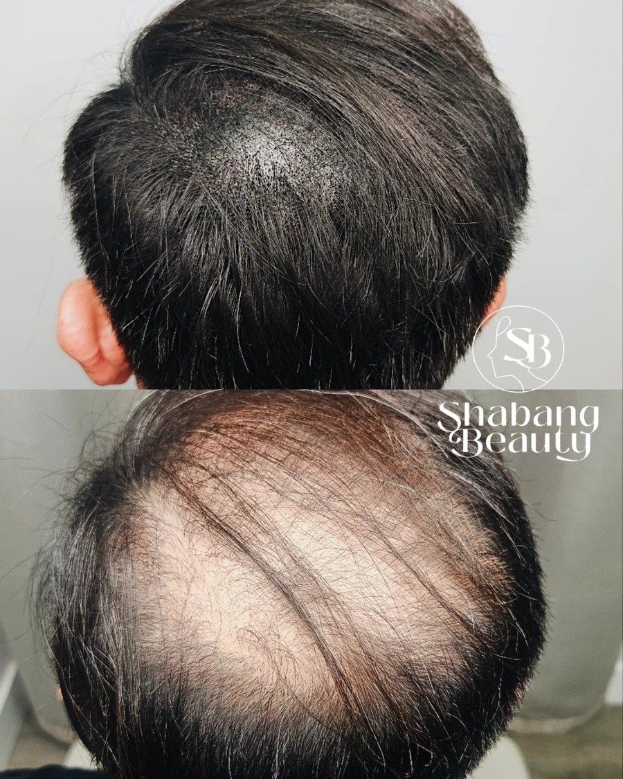 Scalp — Shabang Beauty client result 12