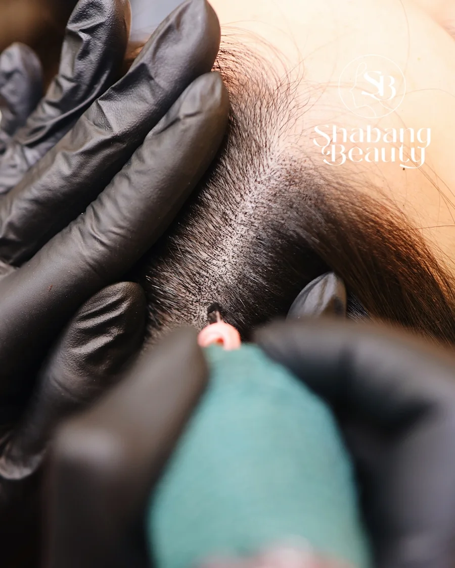 Scalp — Shabang Beauty client result 7
