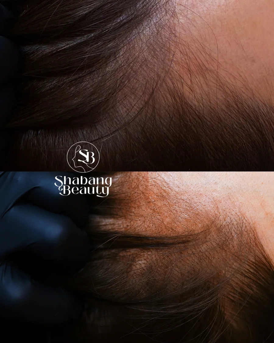 Scalp — Shabang Beauty client result 20